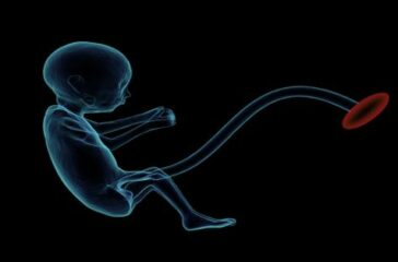 fetus-1788082_640-1200x628