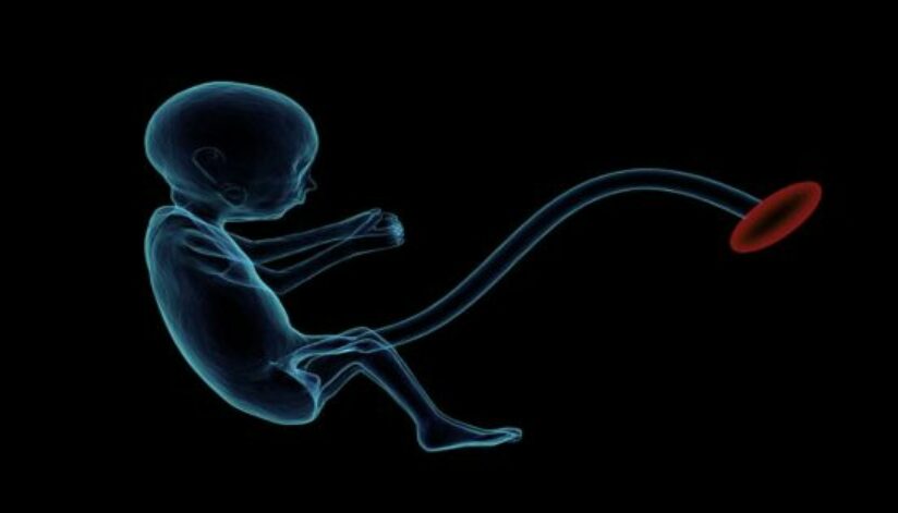 fetus-1788082_640-1200x628